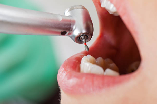 Best Emergency Treatment for Jaw Pain or Injury in Port Wentworth, GA